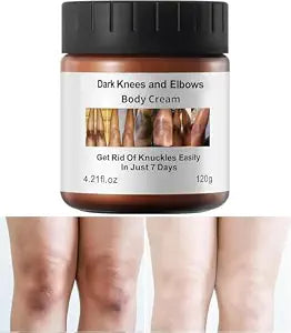 Dark Knees Remover Underarm Cream Body Moisturizer Lotion Dark Toe Knuckles