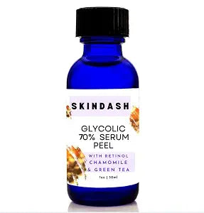 70% Glycolic Acid Serum Peel - with Retinol & Chamomile Green Tea ExtractS For Wrinkles, Acne Scars, Fine Lines, Collagen Boost – Anti -Aging Alpha Hydroxy Acid 1oz Bottle