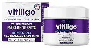 Vitiligo Cream for White Spots (4oz) - Repigmenting Cream with Polypodium Leucotomos and Melanocyte Support - Evens Skin Tone and Reduces Discoloration by Aura Dermacare