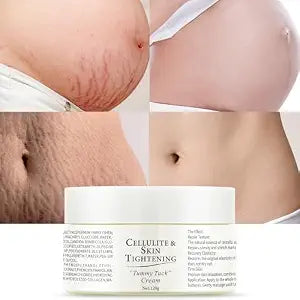 Stretch Marks Removal Cream for Pregnancy,Mama Belly Butter 4.23oz